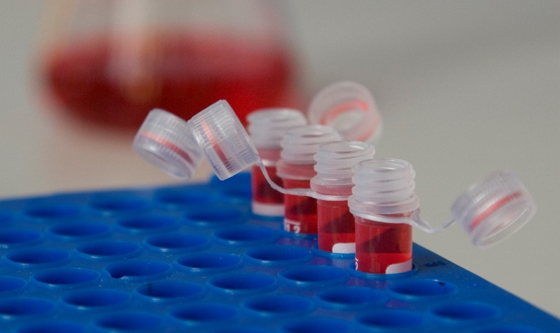 Odczynniki chemiczne Fot. Freeimages